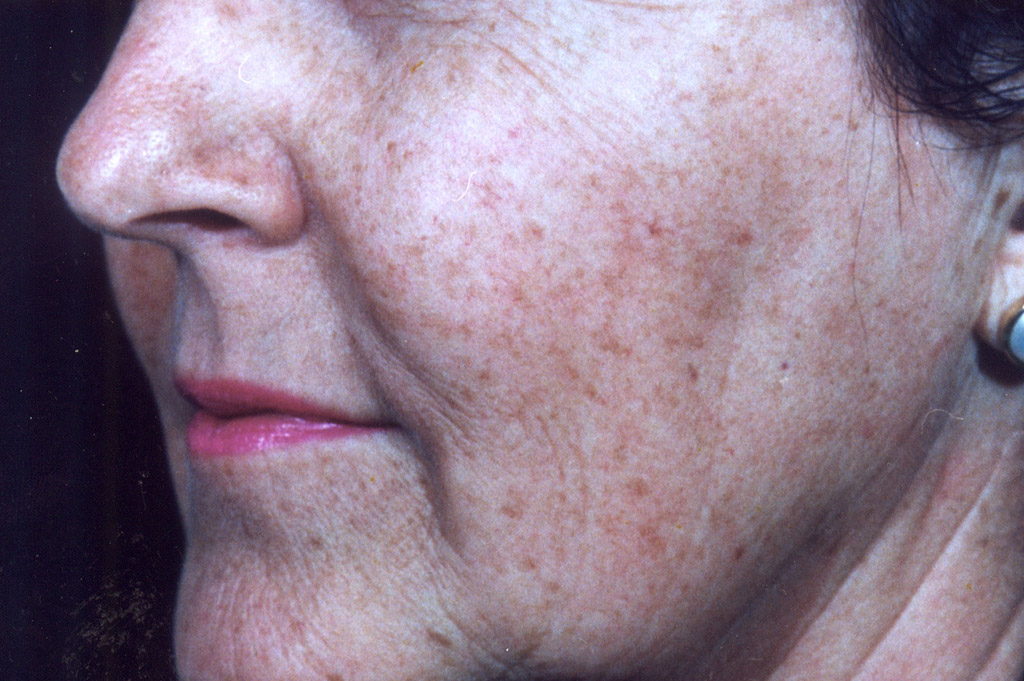 Environ Skin Care | What it can do for skin - Ageing Skin - Before
