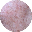 Environ Skin Care | What it can do for skin - Ageing Skin