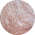 Environ Skin Care - What it can do for skin - Dry Skin