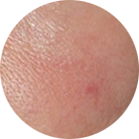 Environ Skin Care | What it can do for skin - Skin Sensitivity