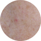 Environ Skin Care | What it can do for skin - Sun Damaged Skin