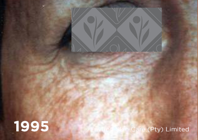 Environ Skin Care | 1995 - Before Ionzyme C-Quence Range