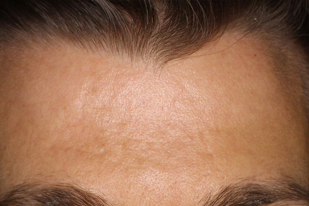 essential moisture boost, after