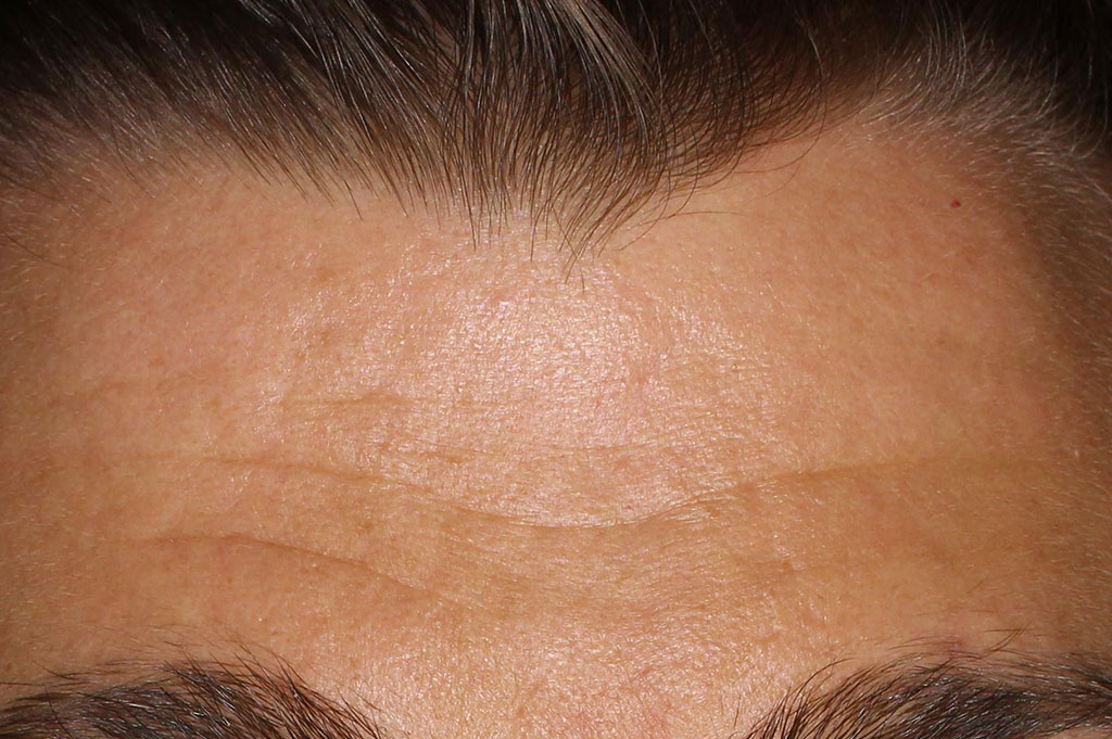 essential moisture boost, before
