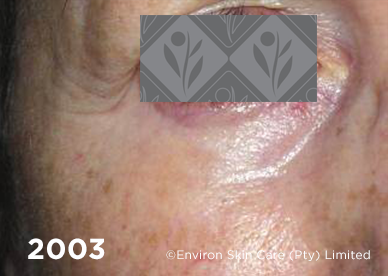 2003 2 - Environ Skin Care